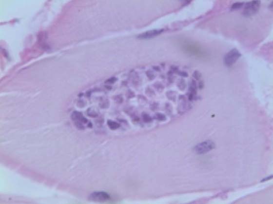 Plasmodia of Kudoa thyrsites within the muscle