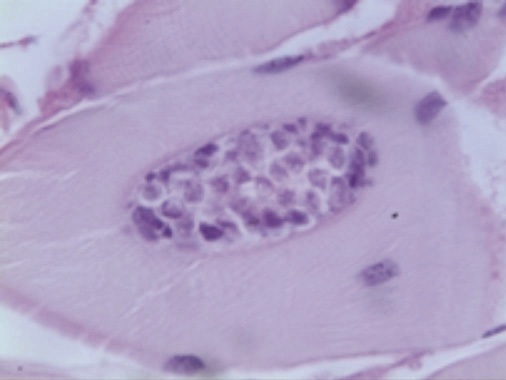 Plasmodium de Kudoa thrysites dans un muscle