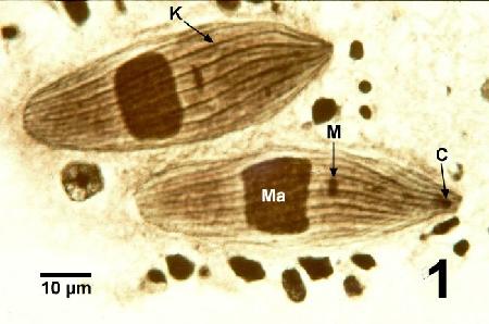 Microscope image of two specimens of Segotricha enterikos