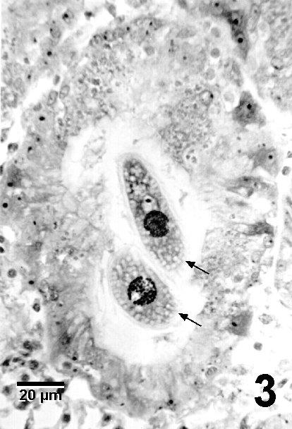 Microscope image of histological section through two Stegotricha enterikos